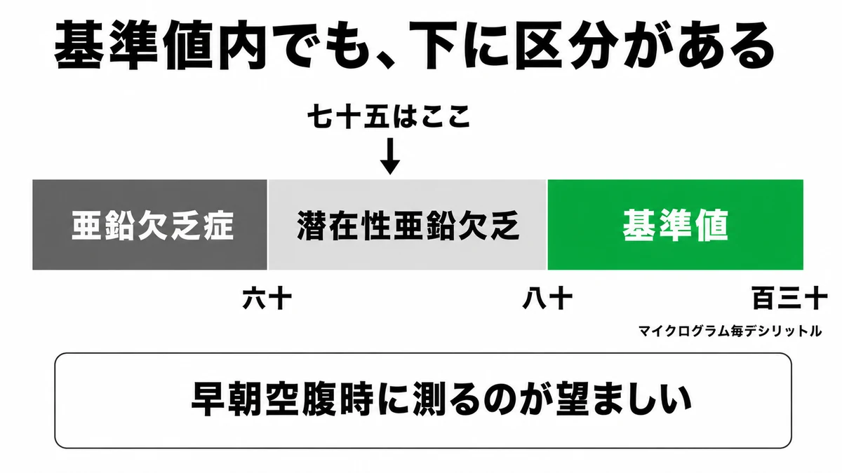 血清亜鉛の基準値80〜130と潜在性亜鉛欠乏60〜80、亜鉛欠乏症60未満の区分を帯で示した図｜血清亜鉛 基準値
